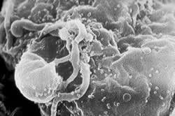 Investigación en la línea de bloquear la fusión de las membranas del virus del sida y la célula diana