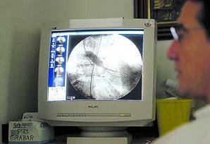 Las visitas de médicos extranjeros al HUCA para observar la técnica empleada en Asturias son abundantes desde hace años