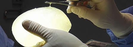 20111224101203-protesis-mamaria-silicona.jpg
