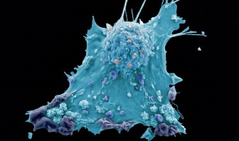 Descubiertas unas células escudo que protegen los tumores
