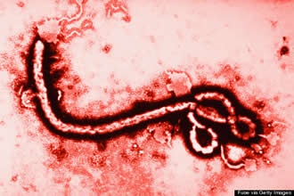 Ebola: por una lado el día a día y por otro las investigaciones en marcha de errores habidos y no sólo en España