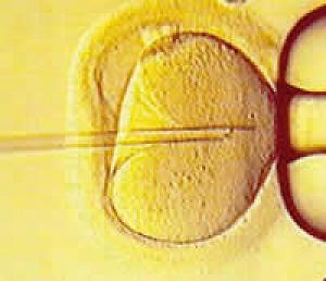 La aprobación en Reino Unido de una nueva técnica reproductiva para evitar enfermedades en bebés reaviva el debate de hasta dónde se puede llegar en la reproducción