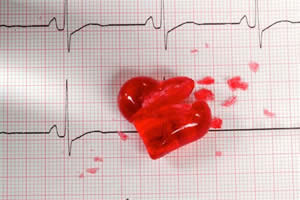 La mortalidad por causa cardiovascular, es de un 32,81% en el Principado